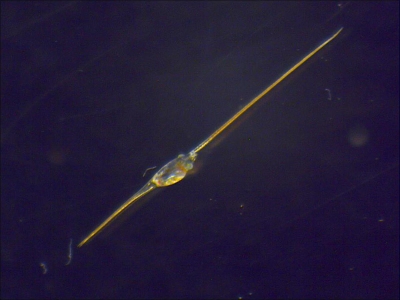 Plancton : Zoé de crabe porcelaine