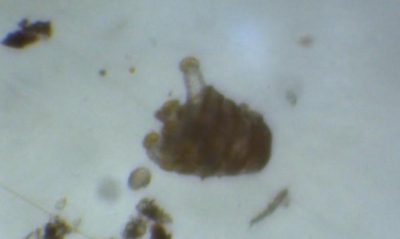 Plancton : Larve pentactula