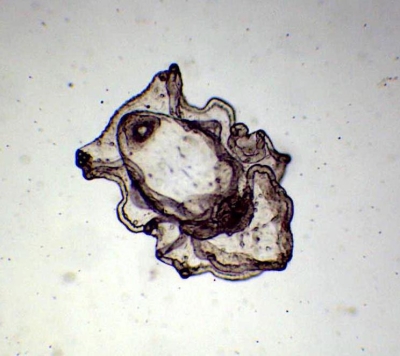 Plancton : Auricularia