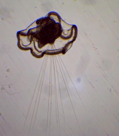 Plancton : Larve mitraria