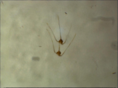 Plancton : Ceratium pavillardii