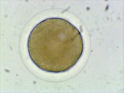 Plancton : Oursin violet (Strongylocentrotus purpuratus)