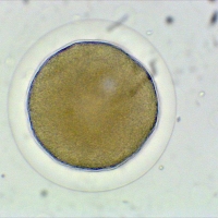 Oursin violet (Strongylocentrotus purpuratus)